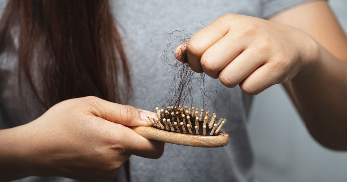 hairloss